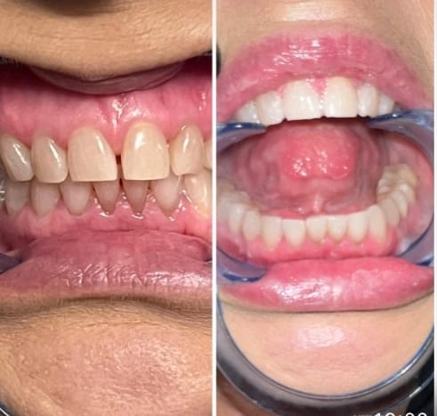 IVISMILE testimonial 2